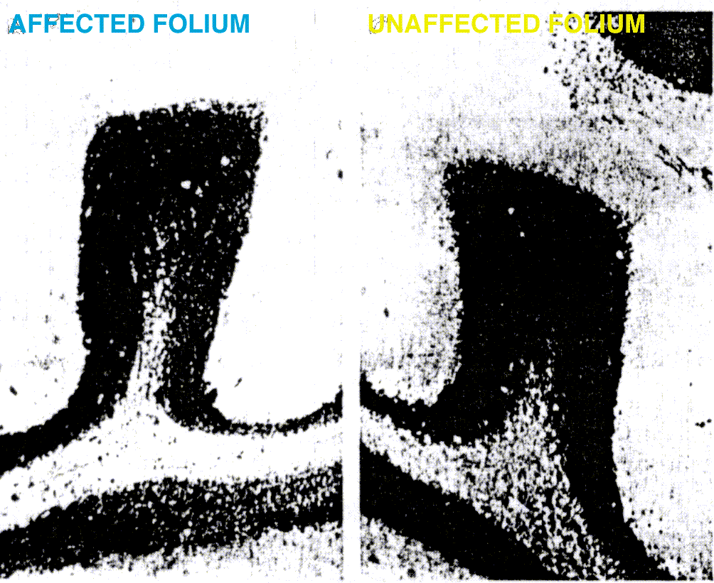 affected folium