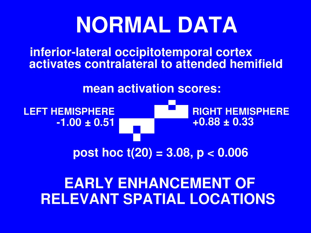 fMRI results: normal subjects, extrastriate