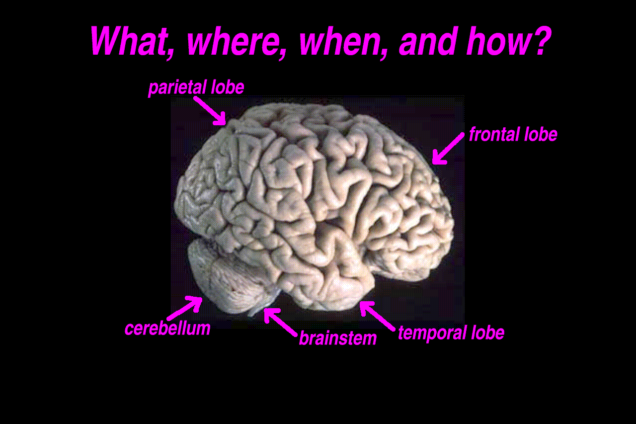 many brain regions have been implicated