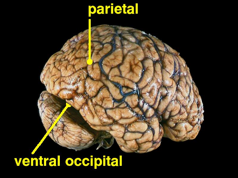 regions of interest