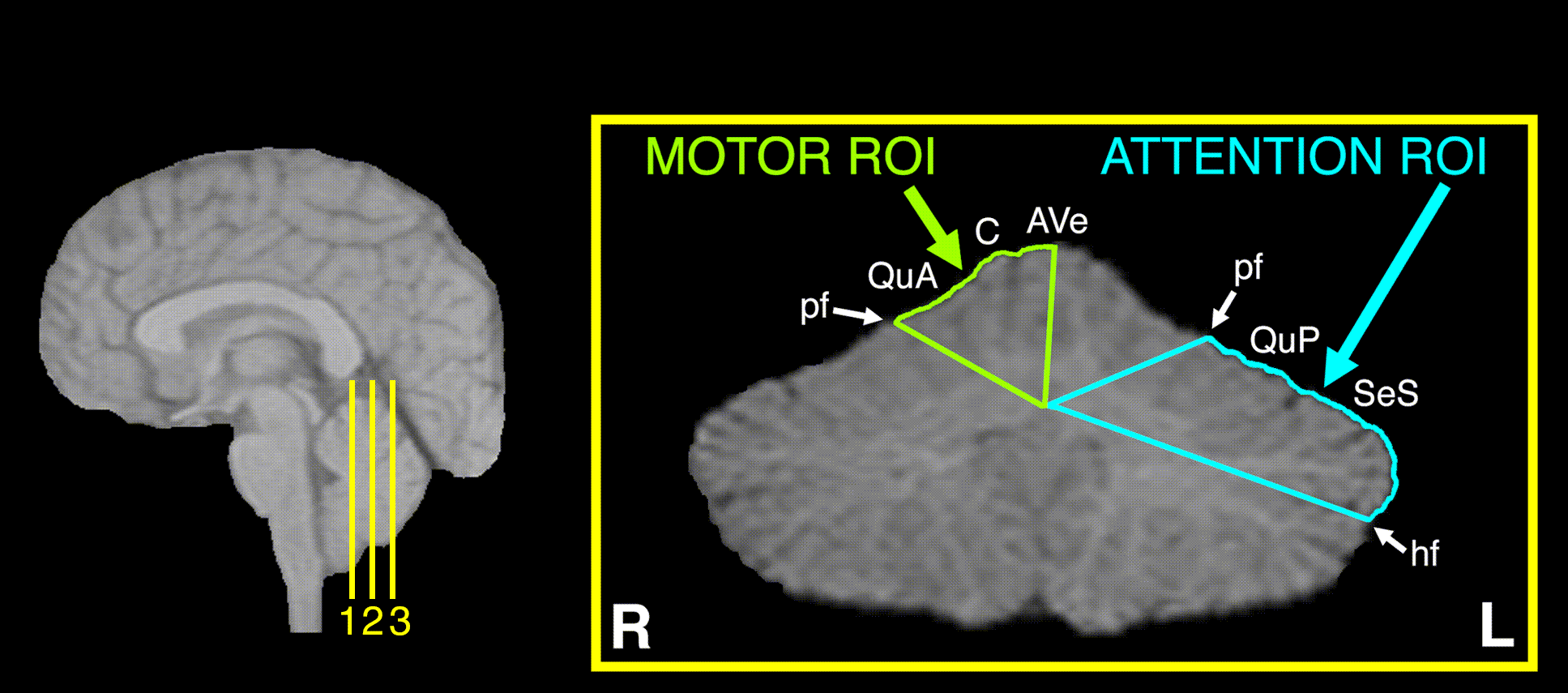 cerebellar regions of interest
