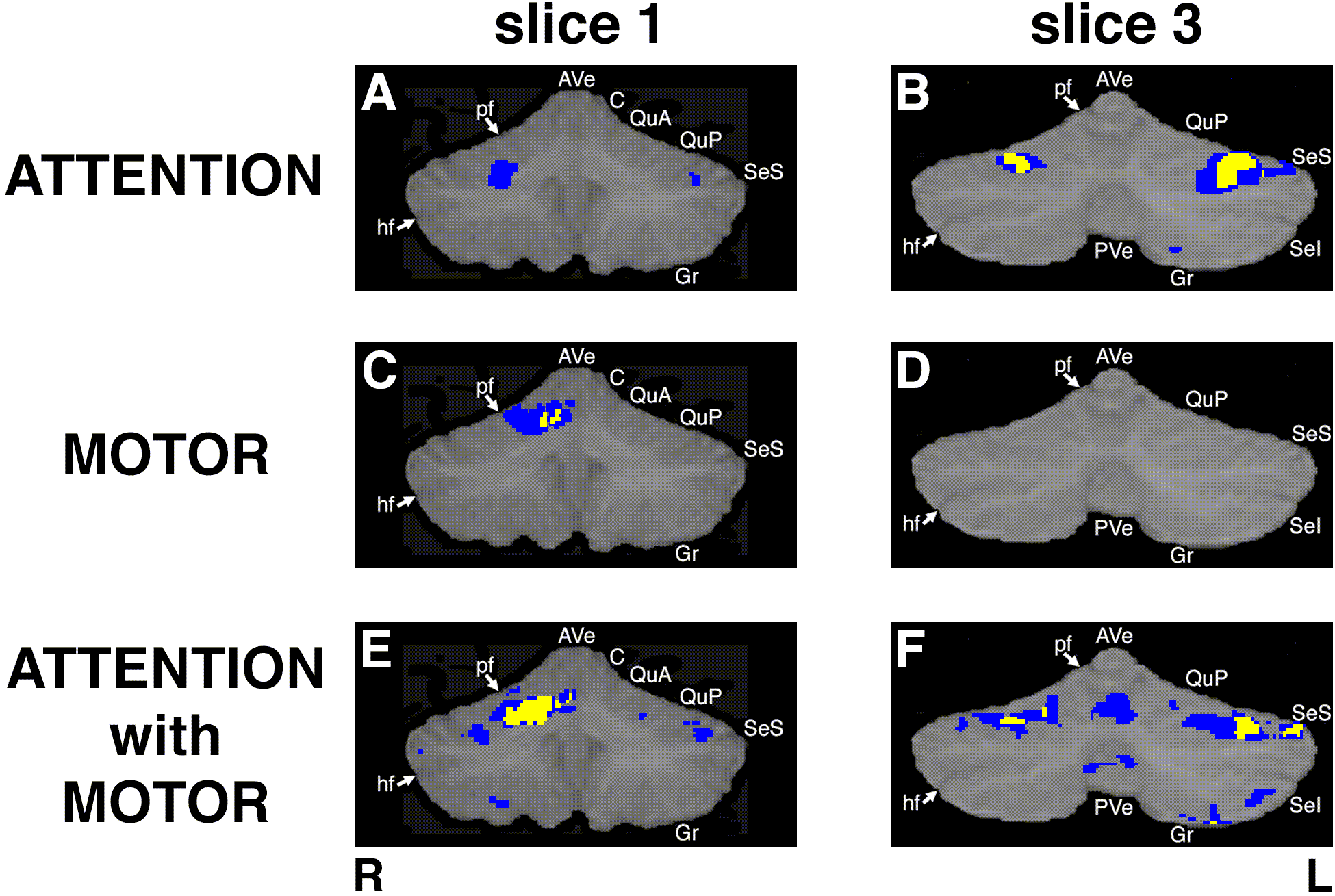cerebellar activations