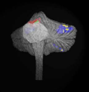 attention-related regions of the cerebellum