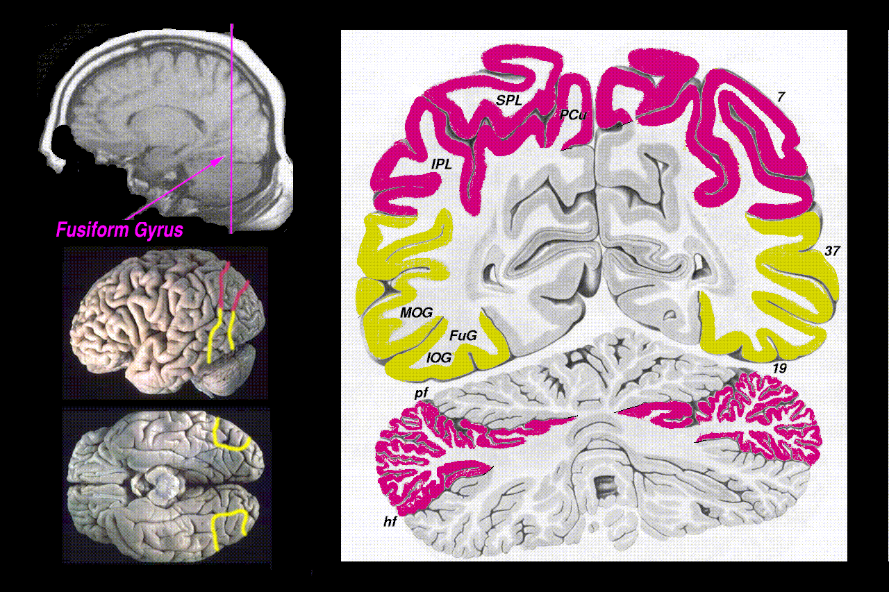 regions of interest, for shift-related and shift-modulated activities, shown on a posterior coronal slice
